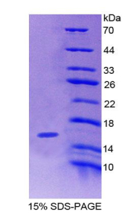 Recombinant Pre-B-Lymphocyte Gene 1 (VPREB1)