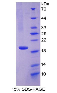 Recombinant Chemerin (CHEM)