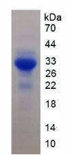 Recombinant Signal Regulatory Protein Beta 1 (SIRPb1)