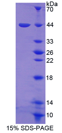 RPA951Hu01.jpg