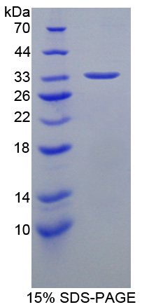 Recombinant Heat Shock Transcription Factor 4 (HSF4)
