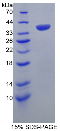 Recombinant Heat Shock Transcription Factor 4 (HSF4)