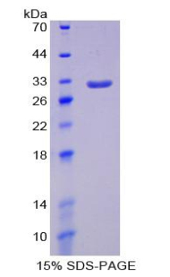 Recombinant Signal Regulatory Protein Alpha (SIRPa)