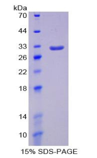 Recombinant Signal Regulatory Protein Alpha (SIRPa)