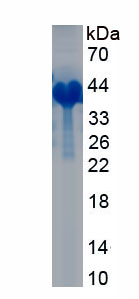 Recombinant Procollagen I N-Terminal Propeptide (PINP)