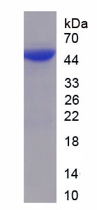 Recombinant Procollagen I N-Terminal Propeptide (PINP)