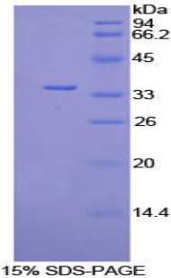 Recombinant Pyruvate Dehydrogenase Kinase 4 (PDK4)