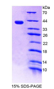 Recombinant Centaurin Alpha 1 (CENTa1)