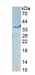 Recombinant Procollagen III C-Terminal Propeptide (PIIICP)