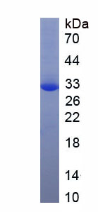 Recombinant Kallikrein 1 (KLK1)