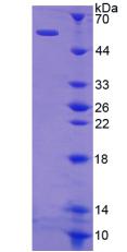 Recombinant Kallikrein 1 (KLK1)