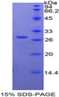 Recombinant Retinoic Acid Receptor Alpha (RARa)