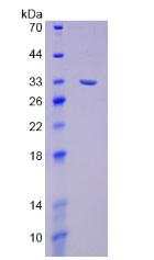 Recombinant Discoidin Domain Receptor Family, Member 1 (DDR1)