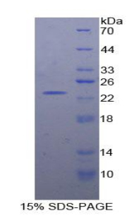 Recombinant Regulator Of G Protein Signaling 4 (RGS4)