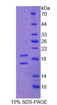 Recombinant Endoglin (ENG)