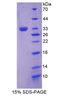 Recombinant Protein Tyrosine Phosphatase Receptor Type H (PTPRH)