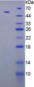 Recombinant Aldosterone Synthase (ALDOS)