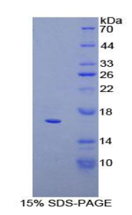 Recombinant Cluster Of Differentiation 160 (CD160)