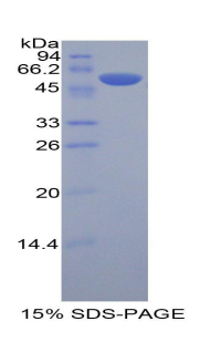 Recombinant Killer Cell Immunoglobulin Like Receptor 3DL2 (KIR3DL2)