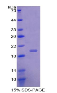 Recombinant Acid Phosphatase 1 (ACP1)