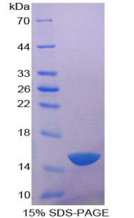 Recombinant Acid Phosphatase 1 (ACP1)