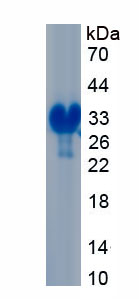 Recombinant Cluster Of Differentiation 320 (C<b>D320</b>)