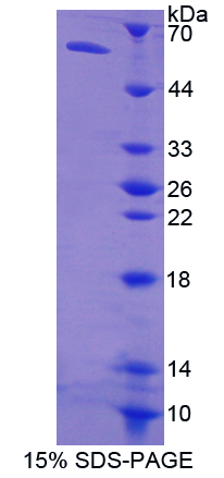 Recombinant Low Density Lipoprotein Receptor (LDLR)