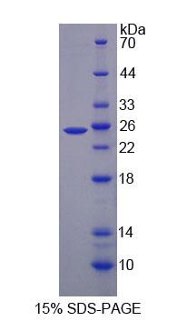 Recombinant Low Density Lipoprotein Receptor (LDLR)