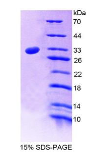 Recombinant Low Density Lipoprotein Receptor (LDLR)