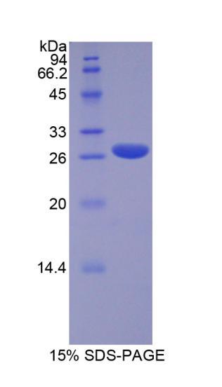 Recombinant Runt Related Transcription Factor 2 (RUNX2)