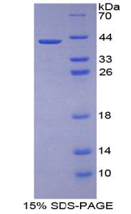 Recombinant Placental Cadherin (P-cadherin)