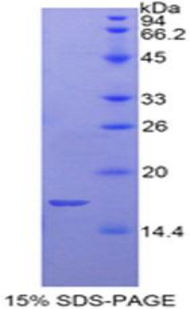 Recombinant Platelet Glycoprotein Ib Beta Chain (GP1BB)