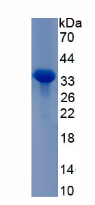 Recombinant Alpha-2-Macroglobulin (a2M)