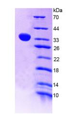 Recombinant Angiopoietin Like Protein 4 (ANGPTL4)