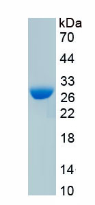 Recombinant Beta Catenin (β-catenin)