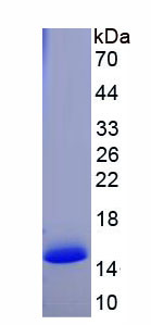 Recombinant Chemokine C-C-Motif Receptor 10 (CCR10)