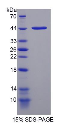 Recombinant Neuromedin U (NMU)