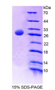 Recombinant Ubiquitin Activating Enzyme E1 Like Protein (UBE1L)