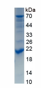 Recombinant Albumin (ALB)