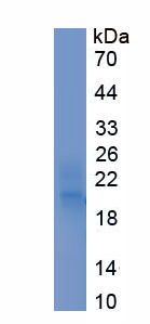 Recombinant Integrin Alpha 2B (ITGa2B)