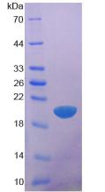 Recombinant Glypican 1 (GPC1)