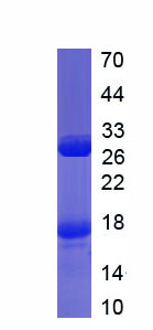 Recombinant Dickkopf Related Protein 2 (DKK2)