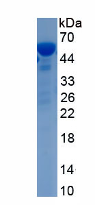 Recombinant Vimentin (VIM)