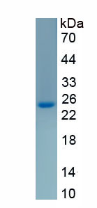 Recombinant Vimentin (VIM)