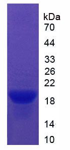 Recombinant Vitronectin (VTN)