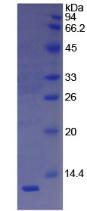 Recombinant Vitronectin (VTN)