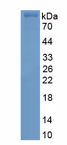 Recombinant Protein Kinase C Beta 1 (PKCb1)