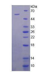 Recombinant Estrogen Receptor Alpha (ERa)