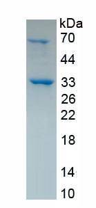 Recombinant Cytochrome P450 7A1 (CYP7A1)