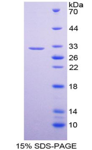 Recombinant Dopachrome Tautomerase (DCT)
